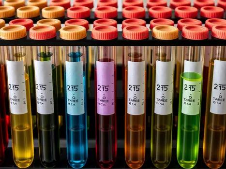 Urine Colours Test Tubes of Urine
