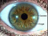 Iris Analysis Pic